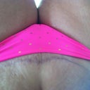 Not sure why it is upside down...my incision is not that long...maybe he will make it longer so I lose the love handles!