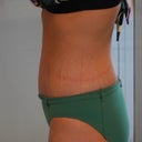3 weeks side