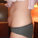 Before - Side View