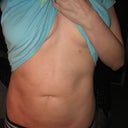5 weeks after - Front View