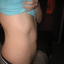 5 weeks after - Side View