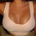 Surgery Day with my awesome compression bra. No joke, I love this bra!!!