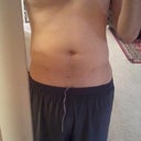 Note 3 small scars. Also, bulge in hip area are is the protrusion of my bone, not a fat bulge.