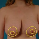 Pre-op photos by Dr. Hammond