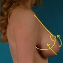 Pre-op photos by Dr. Hammond