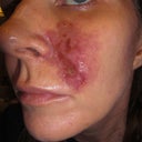 This is how I looked on my 11th anniversary with my husband.  It was horrific.  