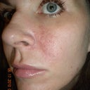the end result.  Not perfect, but much better.  I wouldn't go through this if someone handed me a million dollars!  Seriously!  My mental health was horrible during this and my children suffered from having a depressed mother for many months.  