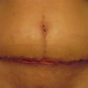 2 Weeks Front View