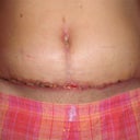 3 weeks Front View
