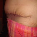 3 weeks side view