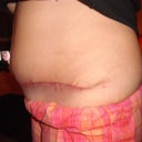 5 weeks Side View
