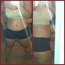 Post Op - Day 7. Don't mind my cottage cheese legs! :)
