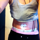 post op day 5 hunched over