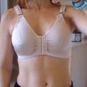 Front on shot. Usually they use bandages w/adhesive but I am allergic to adhesive so they had to put me in this bra.
