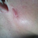 scar from whatever they messed up still don't know how this happened