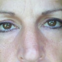 Uneven puckers, very embarrassing!!!! 