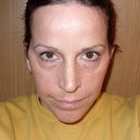 Points on the side of my face 3 months out