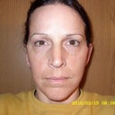Three months after