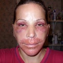 Three days after