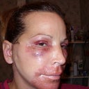 Three Days after