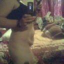 befor my tummy tuck