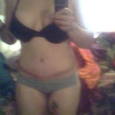 two weeks after tummy tuck