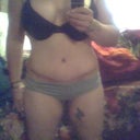 two weeks after tummy tuck