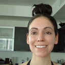 4 month post-op