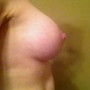 6 month lateral rt