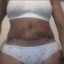 4 weeks po front
