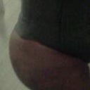 post-op five weeks love my roundness