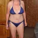 2 weeks post op