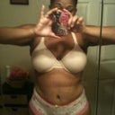 2 Weeks Post Op...