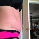 Side view at 8 weeks. Still living with a smidge of swelling. This is a morning pic before exercise.