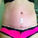 8 weeks PO