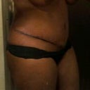Right side 2 wks PO