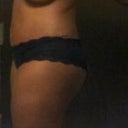 Left side 2 wks PO