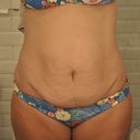front view day before op
