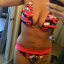 May 2012  1 year post op