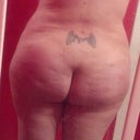4 weeks post op