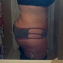12 weeks post op