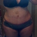12 weeks post op