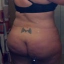 12 weeks post op