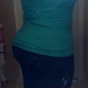 12 weeks post op