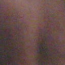2 Days post op