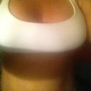 monday aug20 they swelling is starting to go down