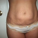 Front pre-mommy makeover
