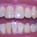 9-26-2012 Tray 15/24