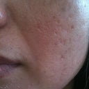 5 days after, left.