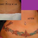 This is the idea for cover up with the tattoo. This is not me, I just like the idea